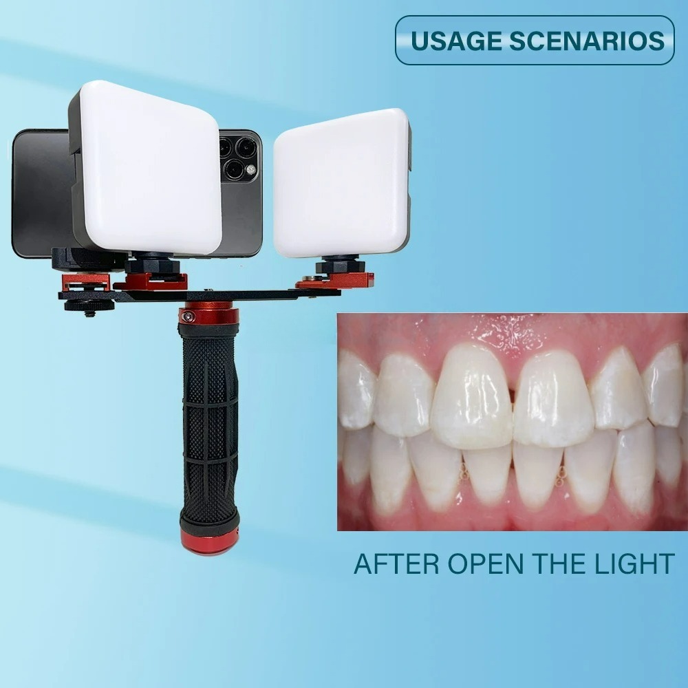 ไฟถ่ายภาพทางทันตกรรมสำหรับโทรศ - Photography Lighting Accessories บทวิจารณ์และราคา