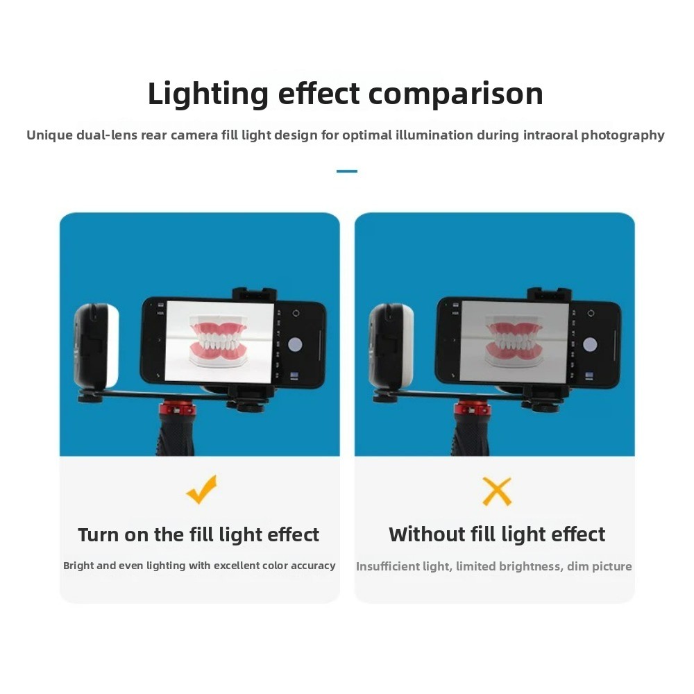 ไฟถ่ายภาพทางทันตกรรม, แฟลช LED - Photography Lighting Set Up บทวิจารณ์และราคา